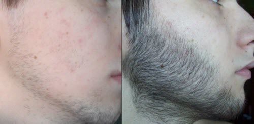Essence nourrissante de croissance de la barbe photo review